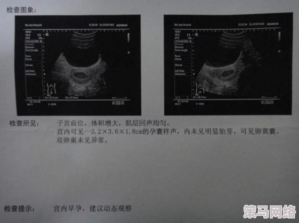 alpha孕囊顶开 分娩：最新进展揭示分娩过程中的关键因素与母婴健康影响